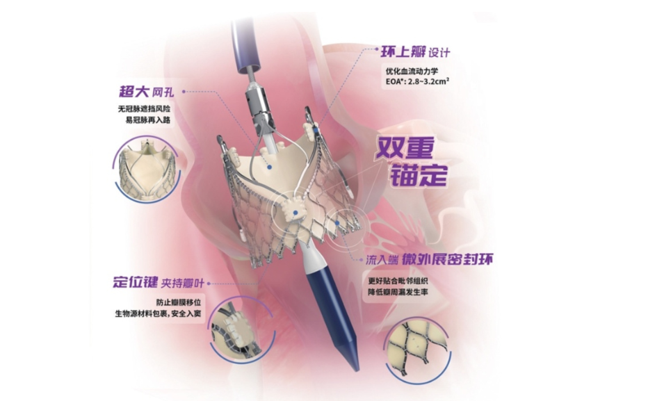 交汇点：苏企立异产品获批上市 让治疗自动脉瓣反流创伤更小