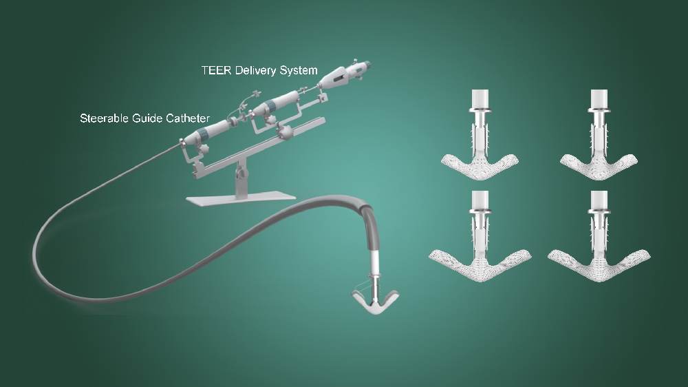 中国原研TEER器械GeminiOne提交EU MDR CE标记注册申请