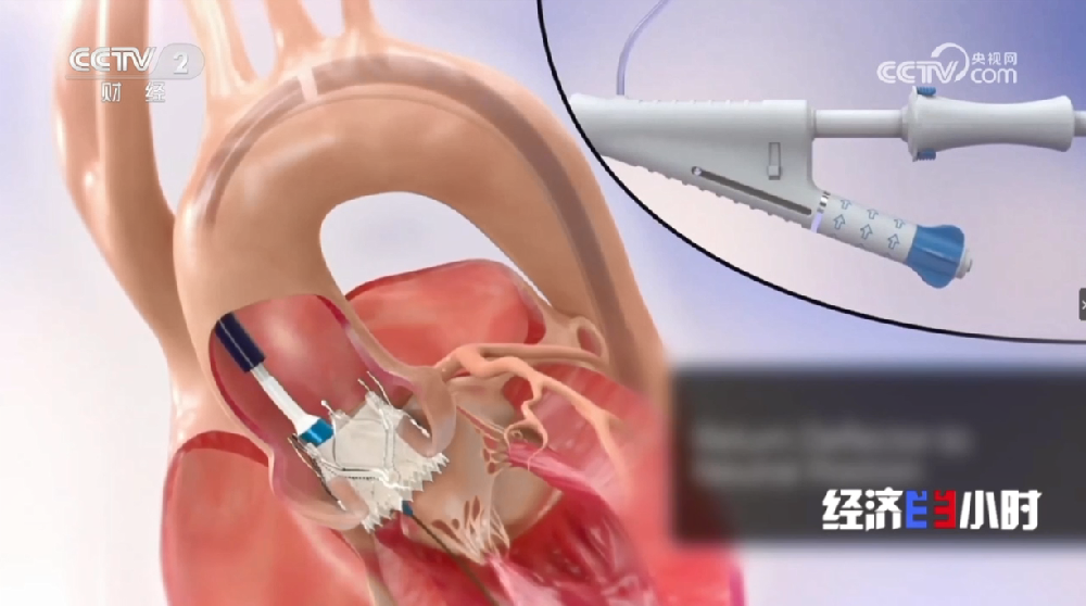 央视点赞旺财28医疗，，，，，，为看病难题提供新解法